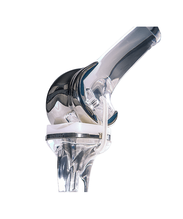 Joint Reconstruction